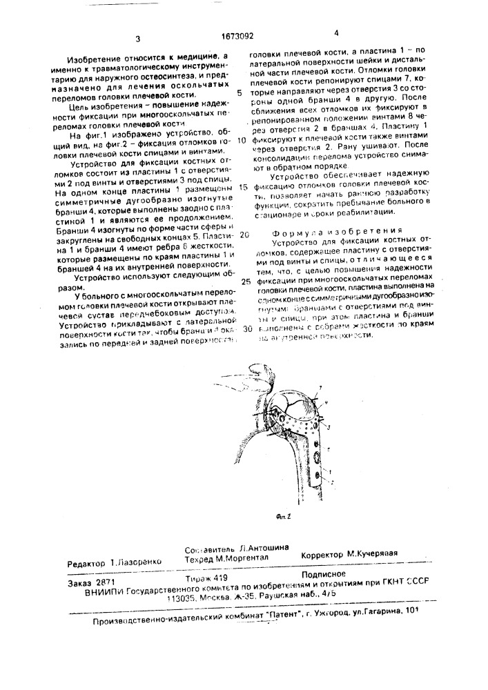 Устройство для фиксации костных отломков (патент 1673092)