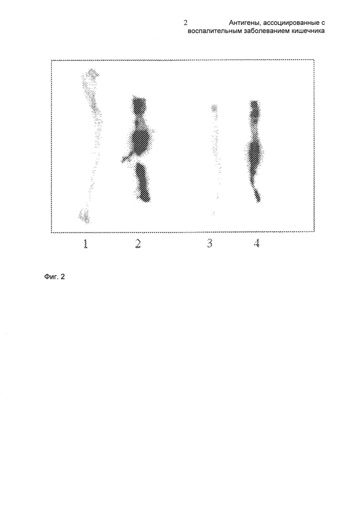 Антигены, ассоциированные с воспалительным заболеванием кишечника (патент 2612878)