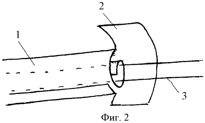 Способ ксенопластики сухожилий сгибателей пальцев кисти (патент 2440057)
