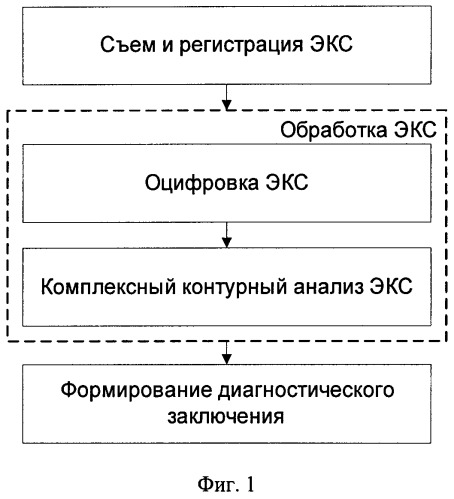 Способ обработки электрокардиосигнала для диагностики инфаркта миокарда (патент 2383295)