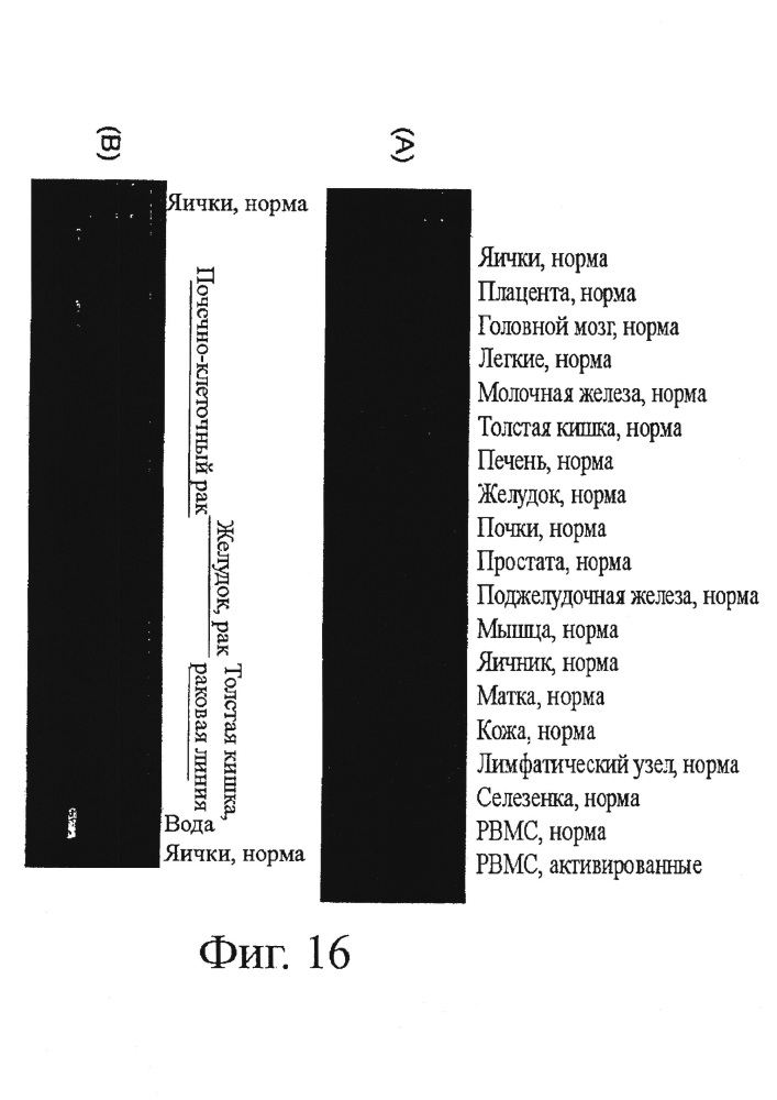 Идентификация опухолеассоциированных антигенов для диагностики и терапии (патент 2644686)