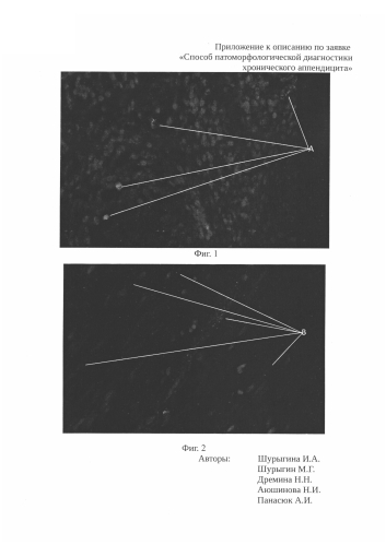 Способ патоморфологической диагностики хронического аппендицита (патент 2582280)