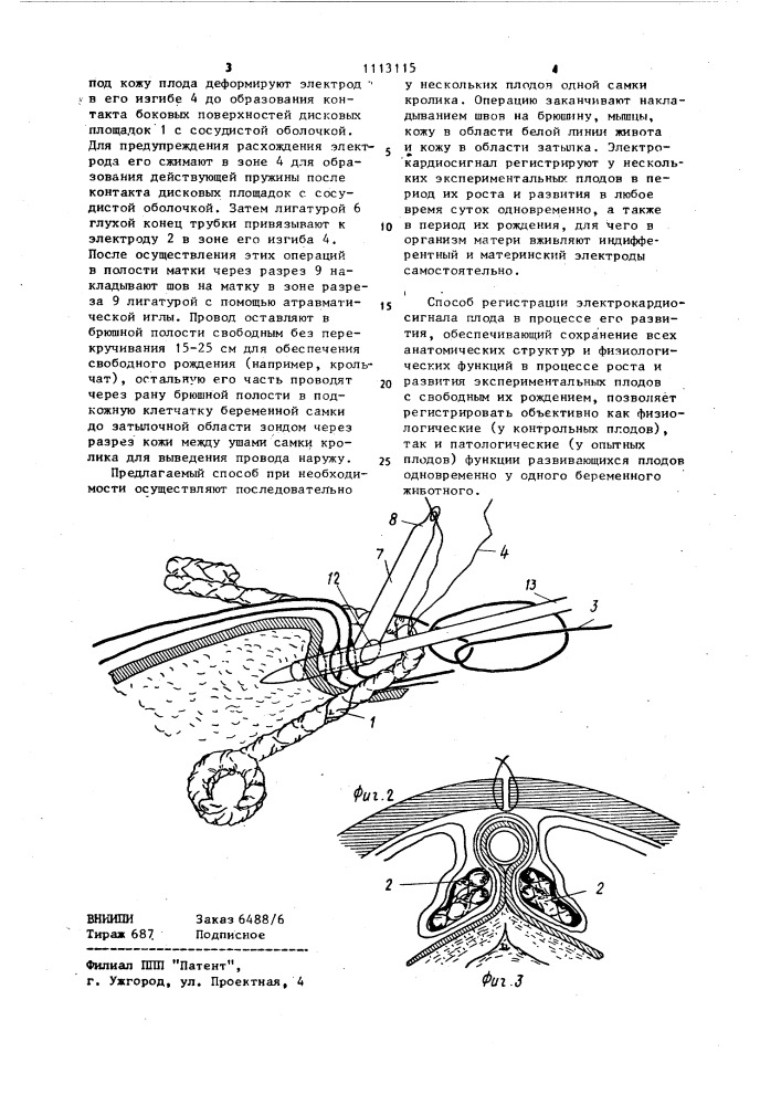 Способ регистрации электрокардиосигнала плода в процессе его развития (патент 1113115)