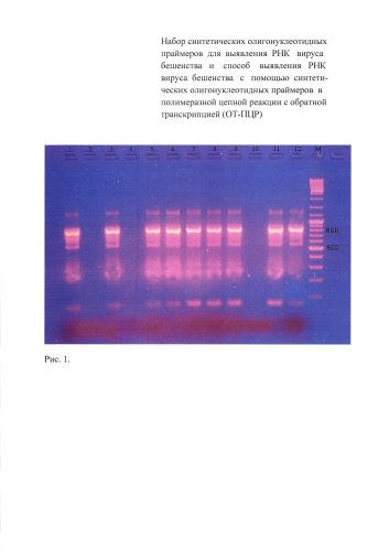 Набор синтетических олигонуклеотидных праймеров для выявления рнк вируса бешенства и способ выявления рнк вируса бешенства с помощью синтетических олигонуклеотидных праймеров в полимеразной цепной реакции с обратной транскрипцией (от-пцр) (патент 2575088)