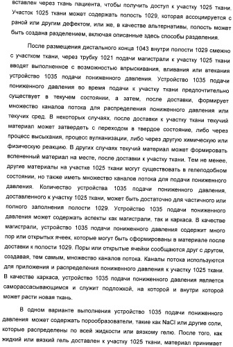 Система и способ продувки устройства пониженного давления во время лечения путем подачи пониженного давления (патент 2404822)