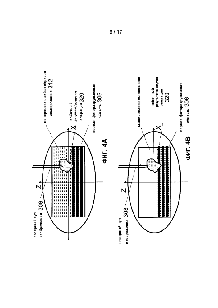 Процессор изображений для внутрихирургического изображения оптической когерентной томографии лазерной операции по удалению катаракты (патент 2627604)