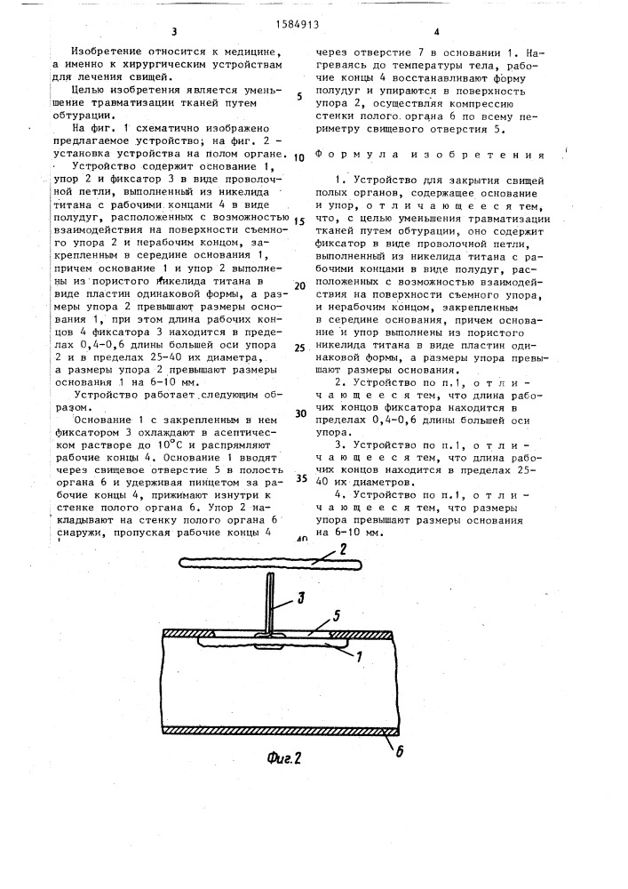 Устройство для закрытия свищей полых органов (патент 1584913)