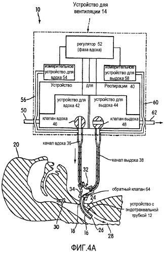 Аппарат для вентиляции и способ, позволяющий пациенту говорить с обратным клапаном трахеостомической трубки или без него (патент 2455031)