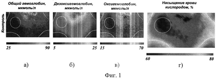 Способ неинвазивного определения кислородного статуса тканей (патент 2498767)