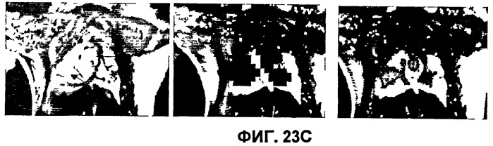 Конъюгаты rgd-пептидов и фотосенсибилизаторов порфирина или (бактерио)хлорофилла и их применение (патент 2450018)