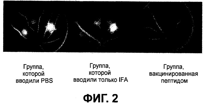 Вакцинотерапия неоваскуляризации сосудистой оболочки глаза (патент 2481118)