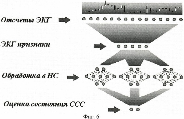 Способ нейросетевого анализа состояния сердца (патент 2461877)