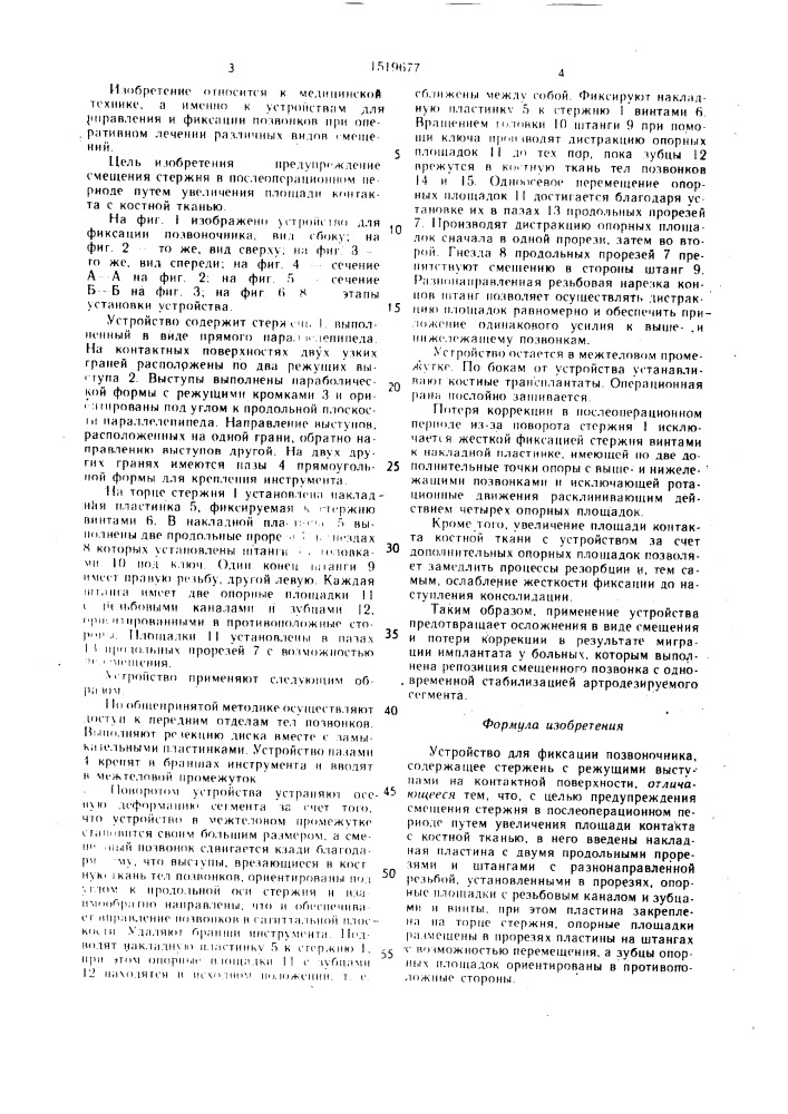 Устройство для фиксации позвоночника (патент 1519677)