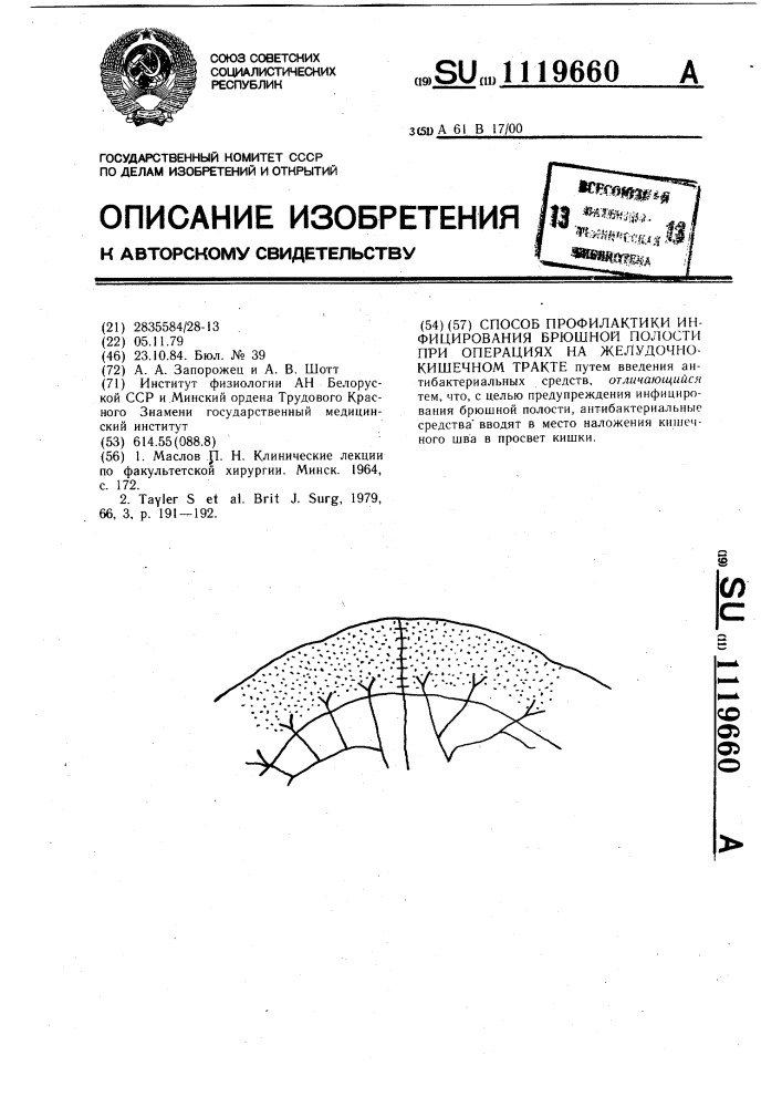 Способ профилактики инфицирования брюшной полости при операциях на желудочно-кишечном тракте (патент 1119660)