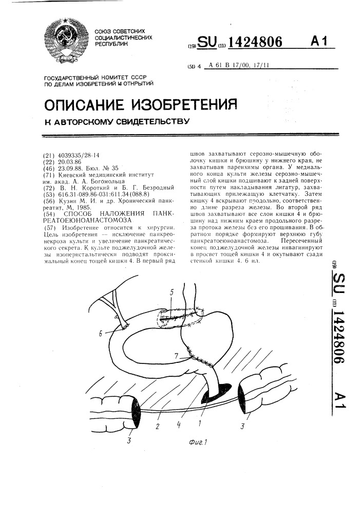 Способ наложения панкреатоеюноанастомоза (патент 1424806)