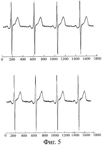 Способ неинвазивного электрофизиологического исследования сердца (патент 2435518)