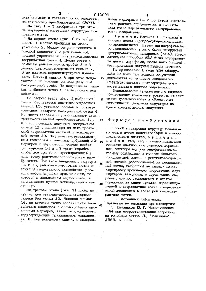 Способ маркировки структур головного мозга (патент 942687)