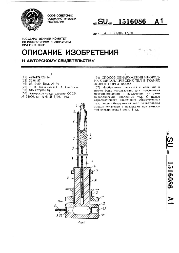 Способ обнаружения инородных металлических тел в тканях живого организма (патент 1516086)