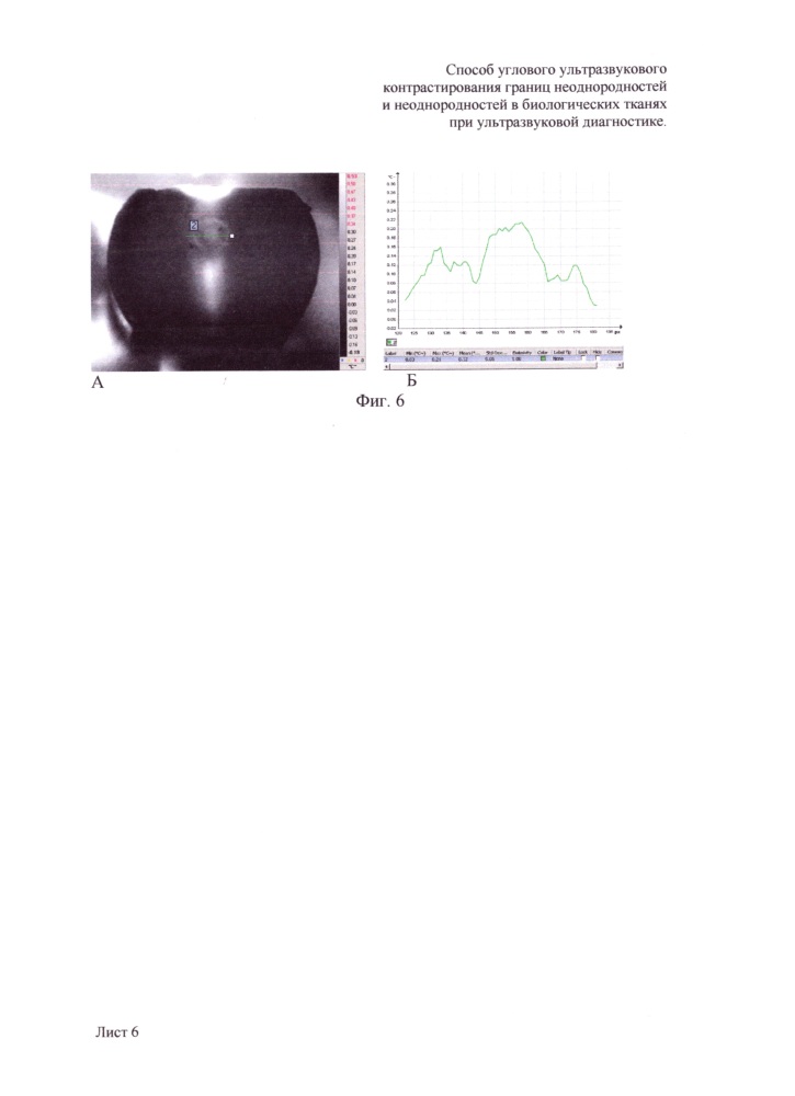 Способ углового ультразвукового контрастирования границ неоднородностей и неоднородностей в биологических тканях при ультразвуковой диагностике (патент 2648880)