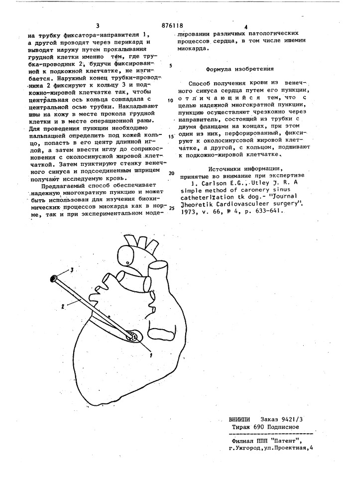 Способ получения крови из венечного синуса сердца (патент 876118)