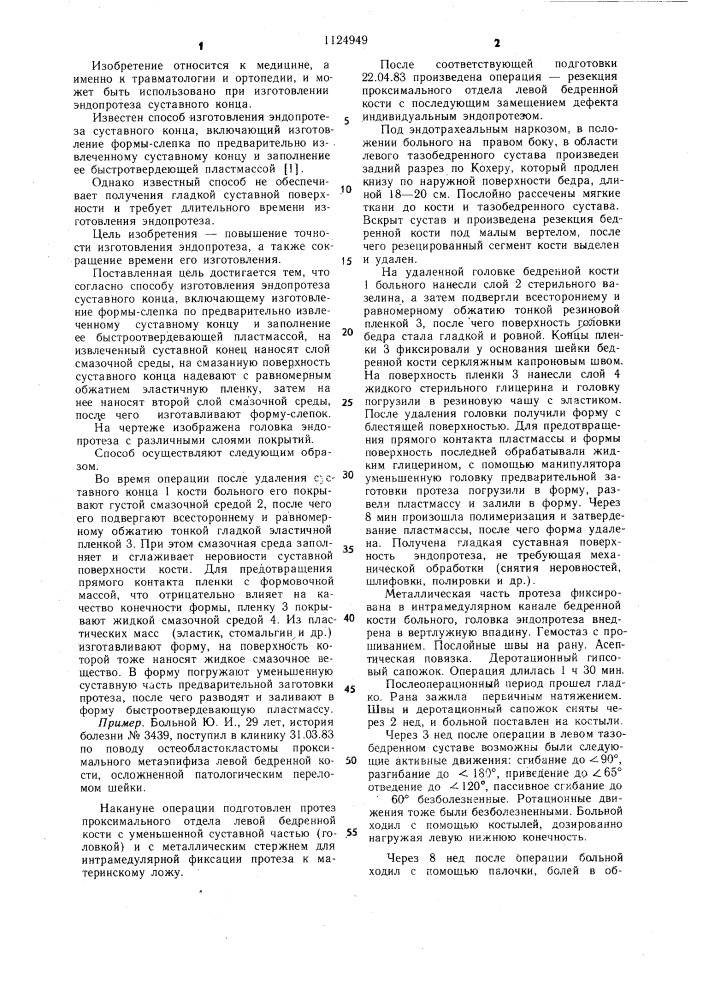 Способ изготовления эндопротеза суставного конца (патент 1124949)