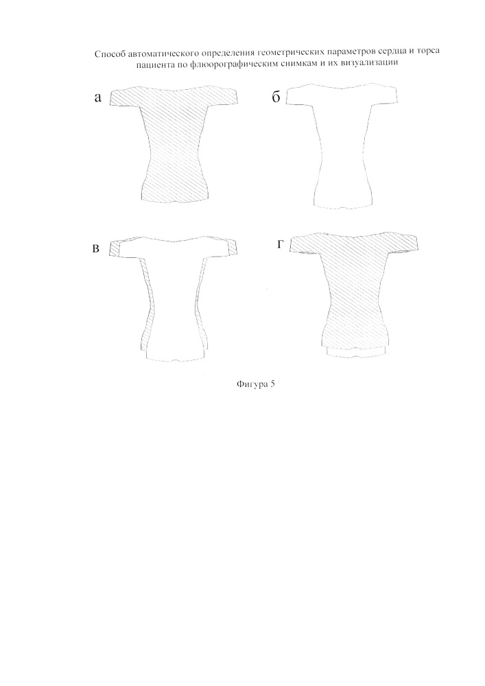 Способ автоматического определения геометрических параметров сердца и торса пациента по флюорографическим снимкам и их визуализации (патент 2639018)
