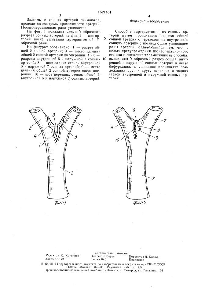 Способ эндартерэктомии из сонных артерий (патент 1521461)