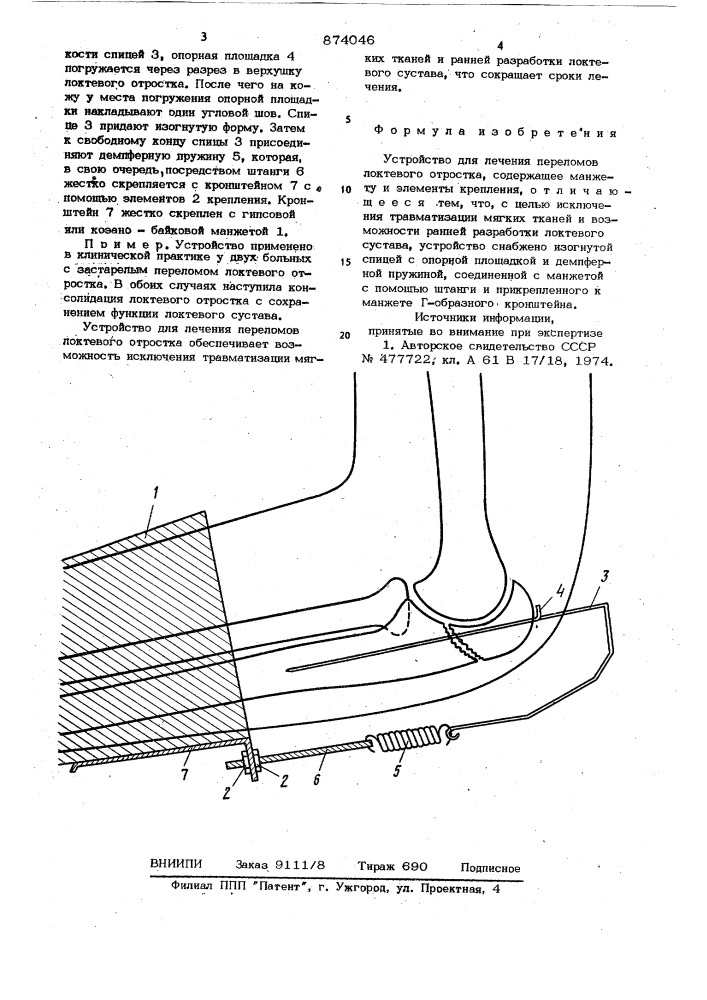 Устройство для лечения переломов локтевого отростка (патент 874046)