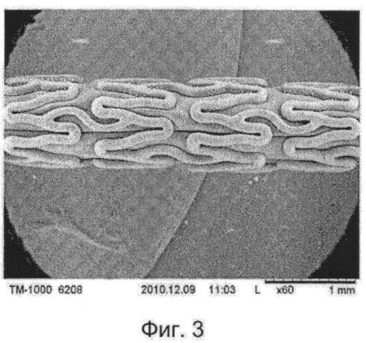 Имплантируемый стент (патент 2571685)