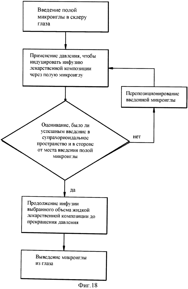 Способы и устройства для доставки лекарственного средства к глазной ткани с помощью микроиглы (патент 2635320)