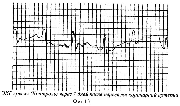 Гиполипидемическое и противоишемическое средство &quot;серпистен&quot; (патент 2337701)