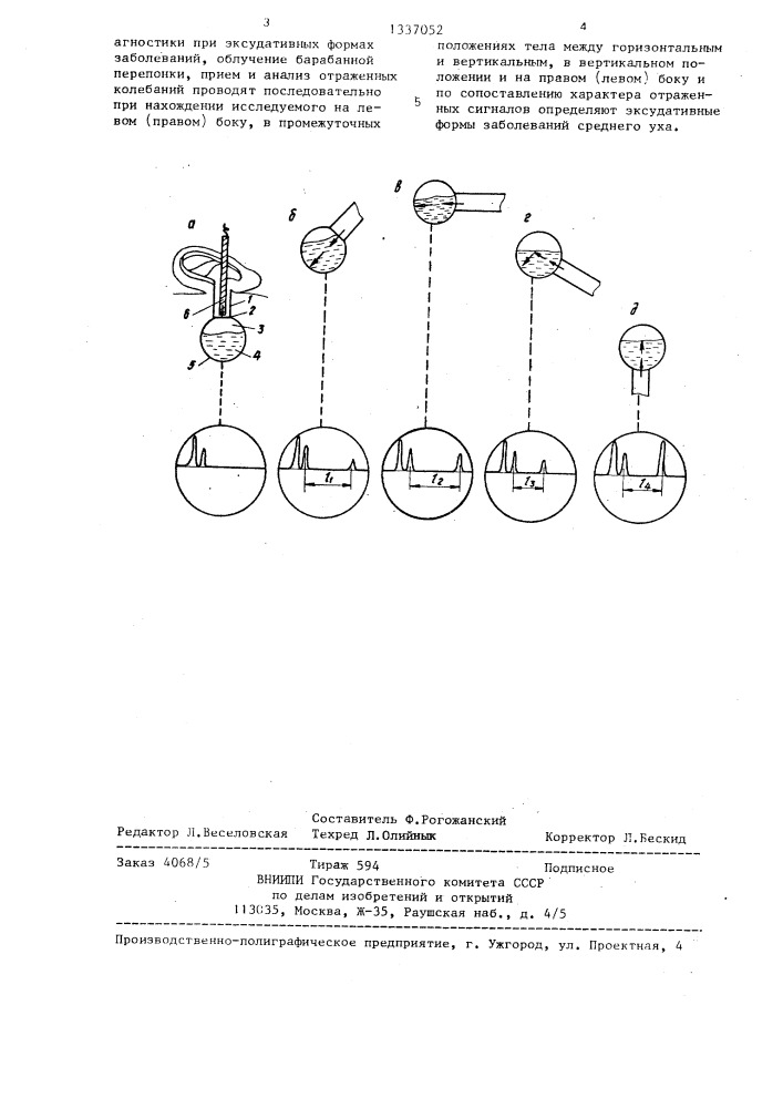 Способ диагностики заболеваний среднего уха (патент 1337052)