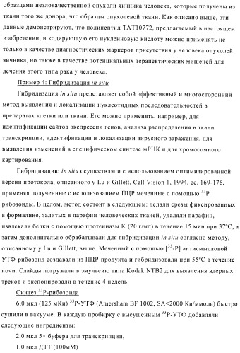 Композиции и способы диагностики и лечения опухоли (патент 2423382)