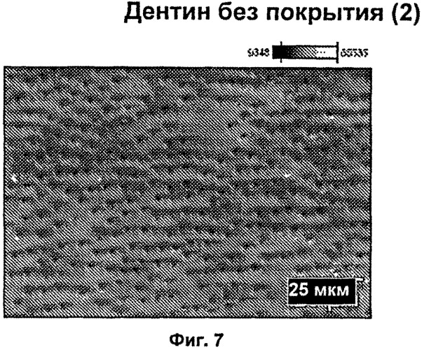 Реминерализация зубов (патент 2559592)