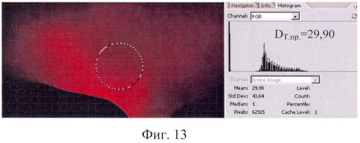 Способ цифровой диафанографической диагностики фронтитов (патент 2405432)