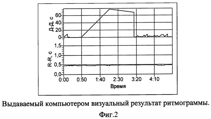 Способ функциональной предоперационной диагностики послеоперационных осложнений у пациентов после протезирующей герниопластики по поводу послеоперационных грыж (патент 2491885)