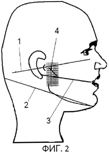Способ нахождения проекции протетической плоскости на лице человека и устройство для его реализации (патент 2504345)