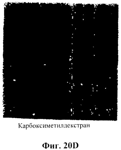 Захват эндотелиальных клеток-предшественников элюирующим лекарственные средства имплантируемым медицинским устройством (патент 2400256)