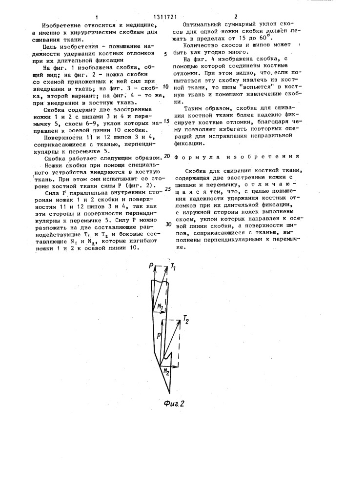 Скобка для сшивания костной ткани (патент 1311721)