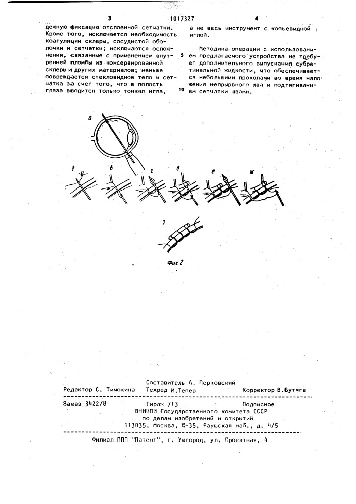 Устройство для хирургического лечения отслойки сетчатки (патент 1017327)