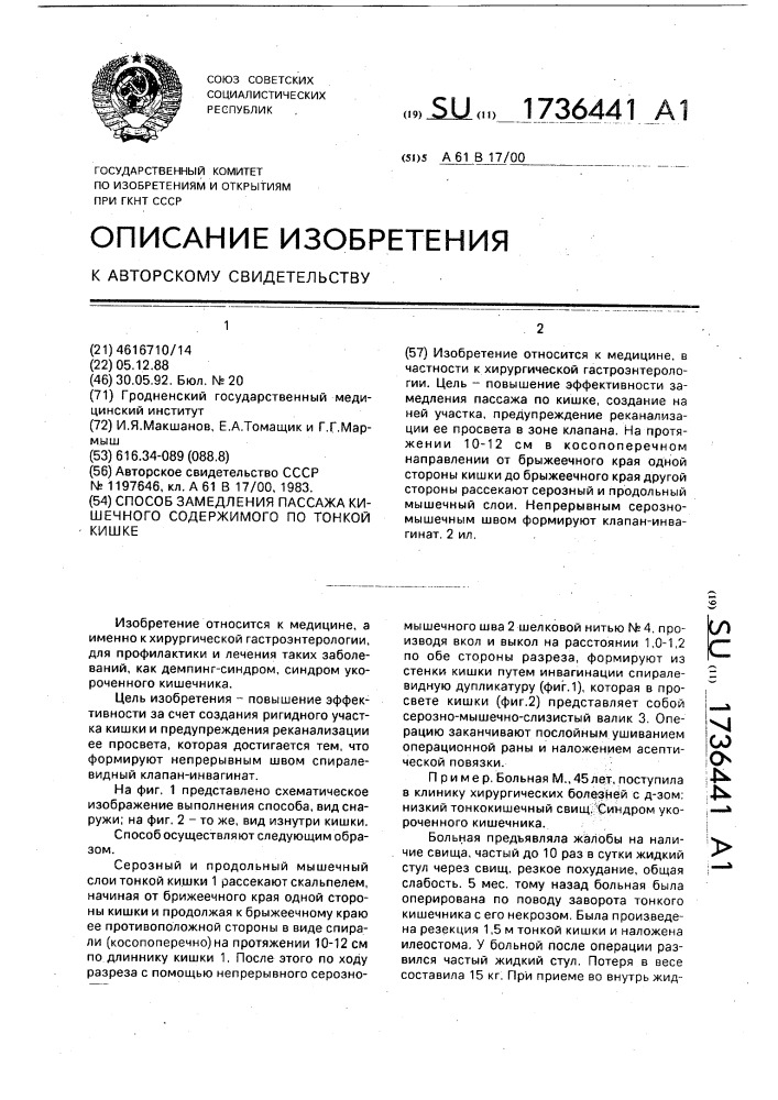 Способ замедления пассажа кишечного содержимого по тонкой кишке (патент 1736441)