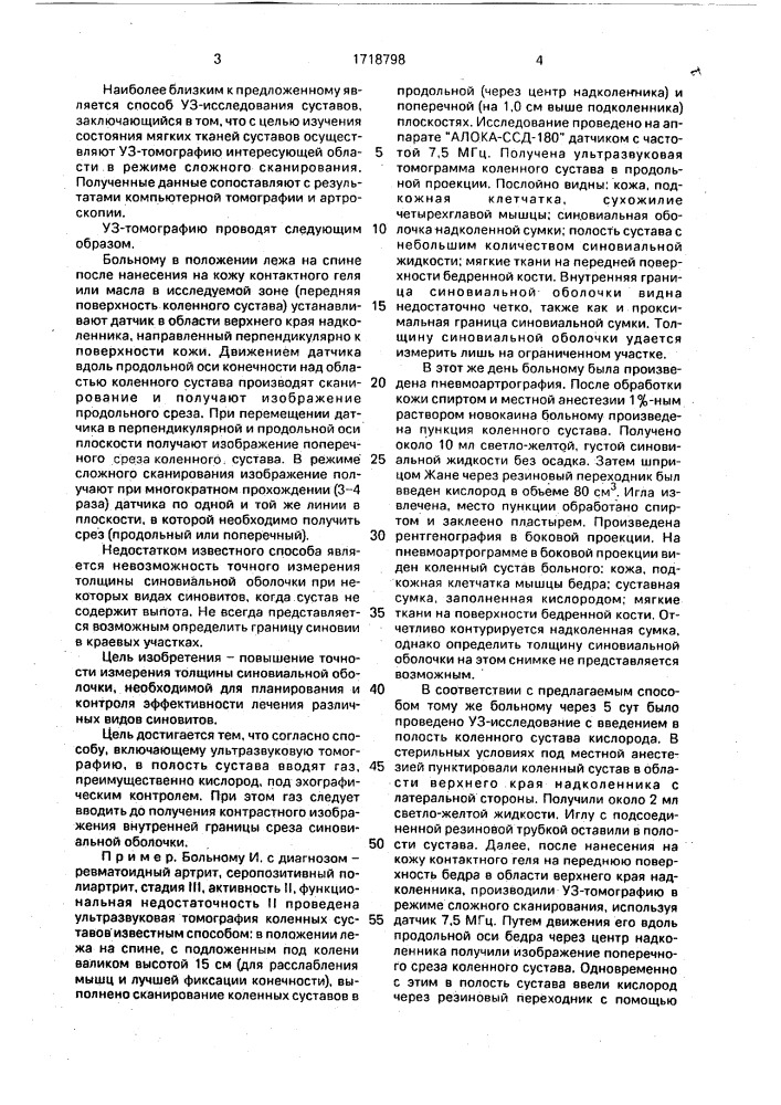 Способ исследования суставов (патент 1718798)