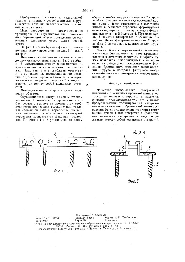 Фиксатор позвоночника (патент 1560171)