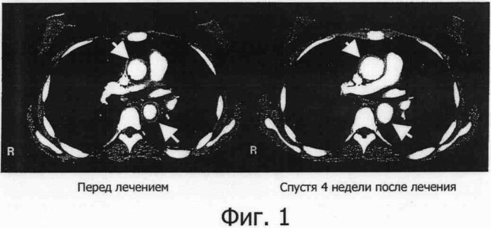 Профилактическое средство против васкулита (патент 2379054)