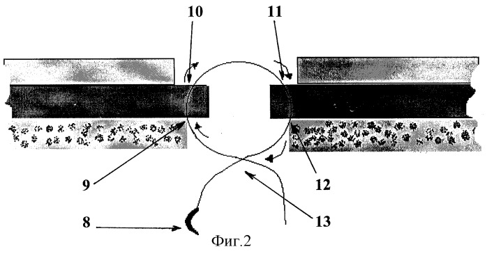 Способ сшивания кожи двурядным швом (патент 2269947)