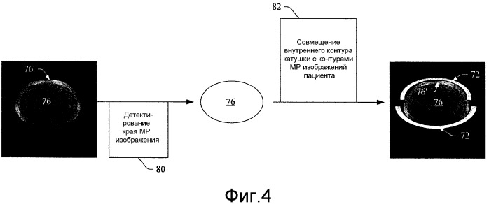 Коррекция ослабления мр катушек в гибридной системе пэт/мр (патент 2518299)