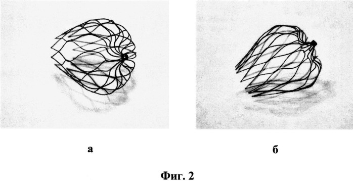 Устройство зонтичное (окклюдер) с модифицированным поверхностным слоем (патент 2522932)