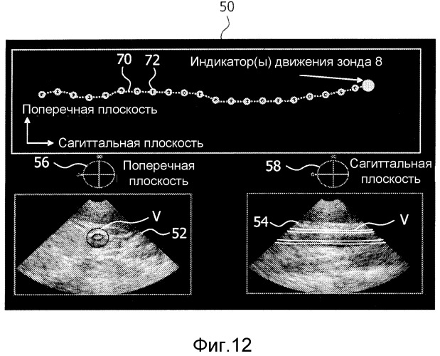 Визуализация ультразвуковых изображений с расширенным полем обзора с помощью двумерного матричного зонда (патент 2507535)