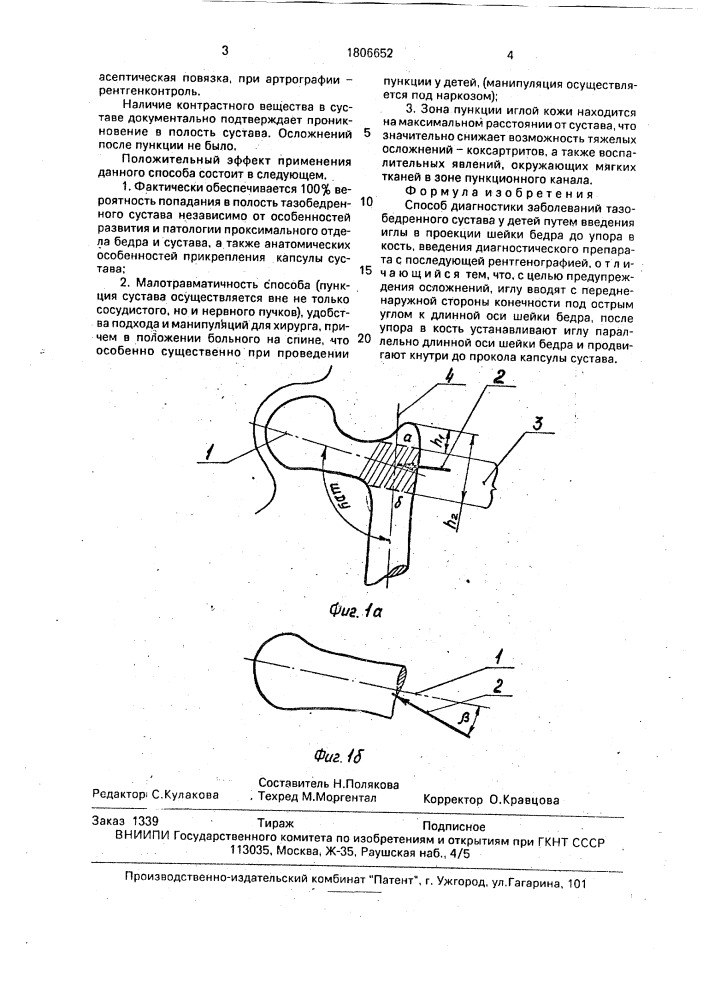 Способ диагностики заболеваний тазобедренного сустава у детей (патент 1806652)
