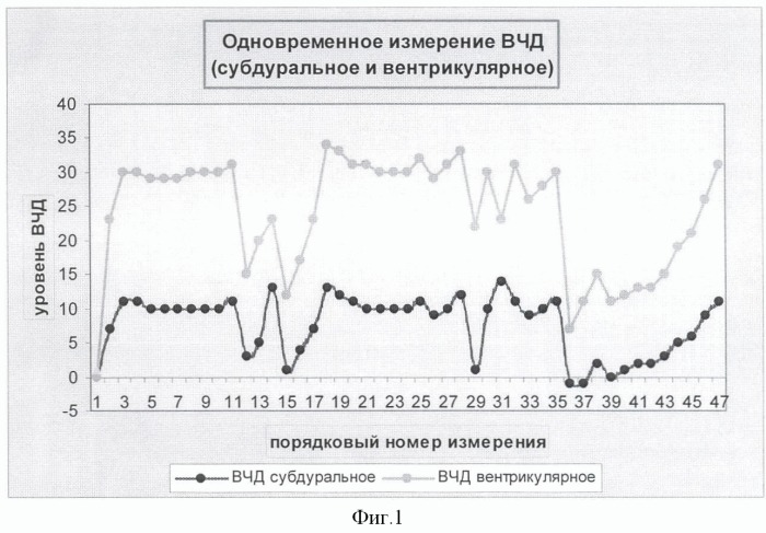 Способ определения причин внутричерепной гипертензии в остром периоде субарахноидального кровоизлияния после разрыва артериальных аневризм (патент 2372027)